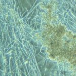 Bactérias filamentosas: aliadas ou vilãs?