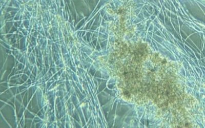 Bactérias filamentosas: aliadas ou vilãs?