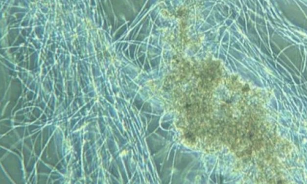 Bactérias filamentosas: aliadas ou vilãs?