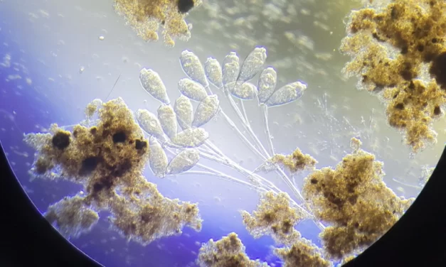 O que é o lodo ativado?